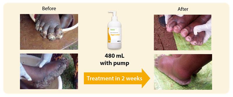 saraya jigger lotion effectiveness